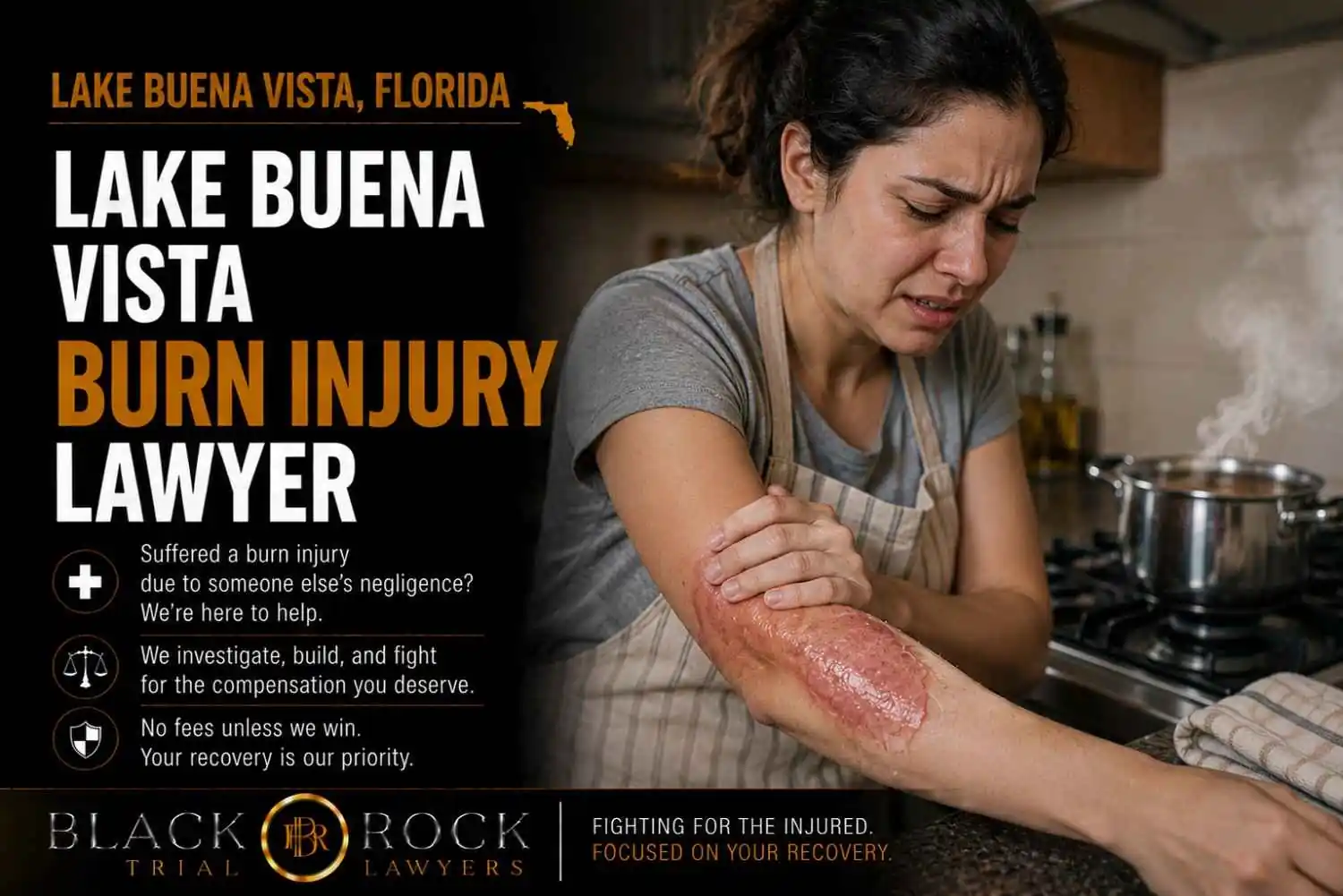 Lake Buena Vista Burn Injury Lawyer